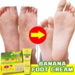 Banana Milk Cracked Heel Cream Buy 1 Get 1 Free