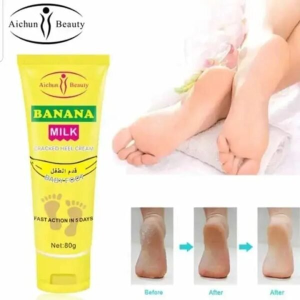 Banana Milk Cracked Heel Cream Buy 1 Get 1 Free
